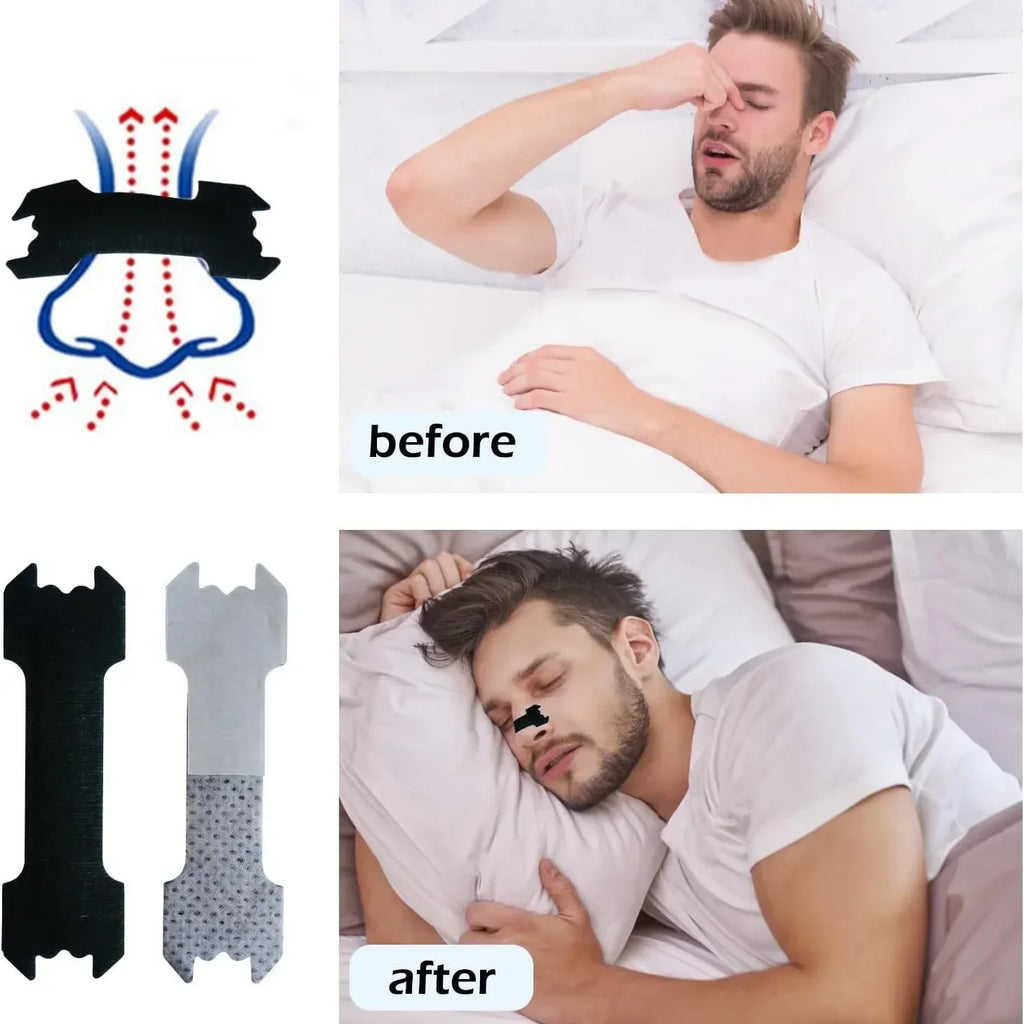 Addsyl Anti-Snoring Strips – Breathable Nasal Sleep Aid
