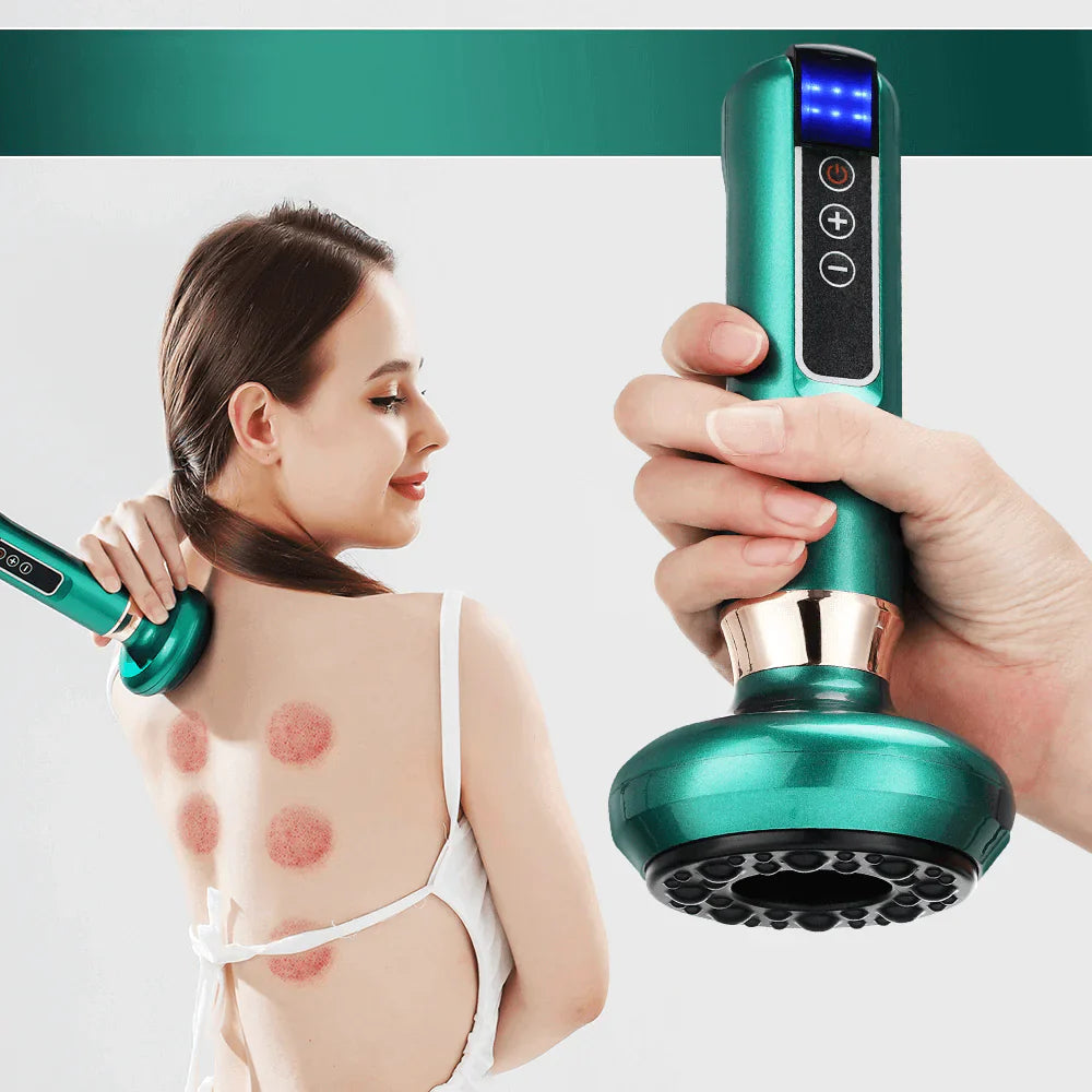 Electric Cupping Therapy Massager – 3-in-1 Scraping, Suction & Heat Relief Device